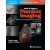 Webb & Higgins Thoracic Imaging: Print + eBook with Multimedia ,4/e