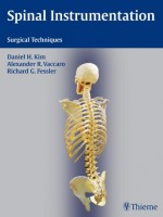 Spinal Instrumentation Surgical Techniques