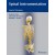 Spinal Instrumentation Surgical Techniques