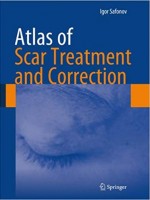 Atlas of Scar Treatment and Correction