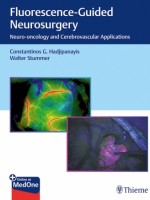 Fluorescence-Guided Neurosurgery