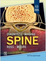 Diagnostic Imaging: Spine, 5e