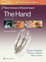 Master Techniques in Orthopaedic Surgery: The Hand,3/e