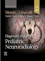 Diagnostic Imaging: Pediatric Neuroradiology 4e
