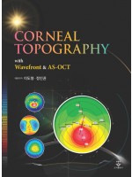 Corneal Topography with Wavefront & AS-OCT