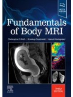 Fundamentals of Body MRI 3e