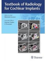 Textbook of Radiology for Cochlear Implants