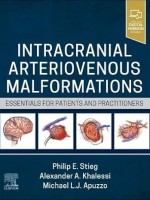 Intracranial Arteriovenous Malformations: Essentials for Patients and Practitioners 1st Edition