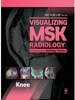 Visualizing MSK Radiology: A Practical Guide to Radiology Mastery