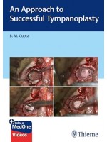 An Approach to Successful Tympanoplasty