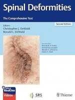 Spinal Deformities: The Comprehensive Text, 2e