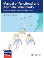 Manual of Functional and Aesthetic Rhinoplasty: Illustrated Stepwise Instructions with Videos