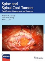 Spine and Spinal Cord Tumors: Classification, Management, and Treatment