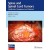 Spine and Spinal Cord Tumors: Classification, Management, and Treatment