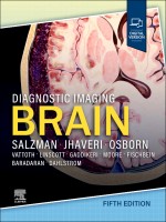 Diagnostic Imaging: Brain, 5/e