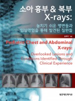 소아 흉부 복부 X-rays 놓치기 쉬운 병변들과 임상경험을 통해 발견된 질환들