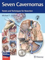 Seven Cavernomas: Tenets and Techniques for Resection