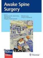 Awake Spine Surgery