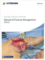 Manual of Fracture Management - Hand