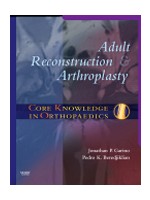 Core Knowledge in Orthopaedics: Adult Reconstruction and Arthroplasty