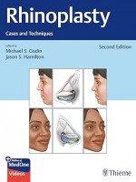 Rhinoplasty : Cases and Techniques, 2/e